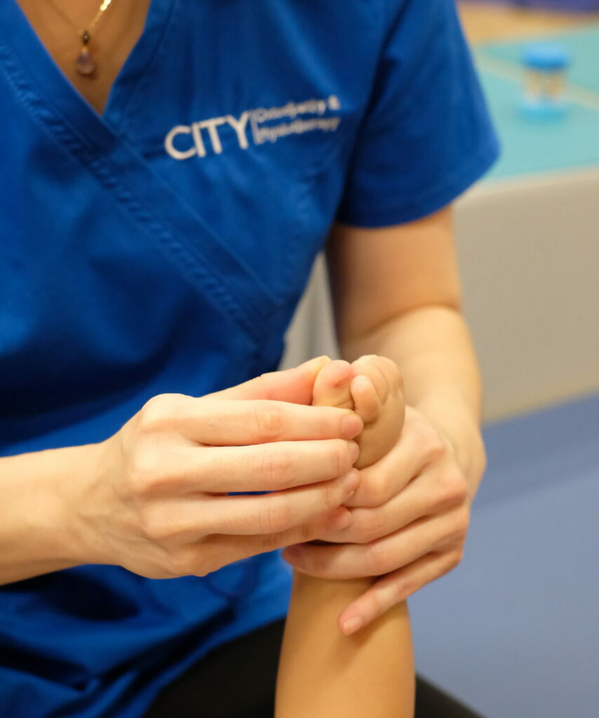 Overlapping Toes in Babies & Children City Osteopathy & Physiotherapy