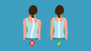 signs of scoliosis