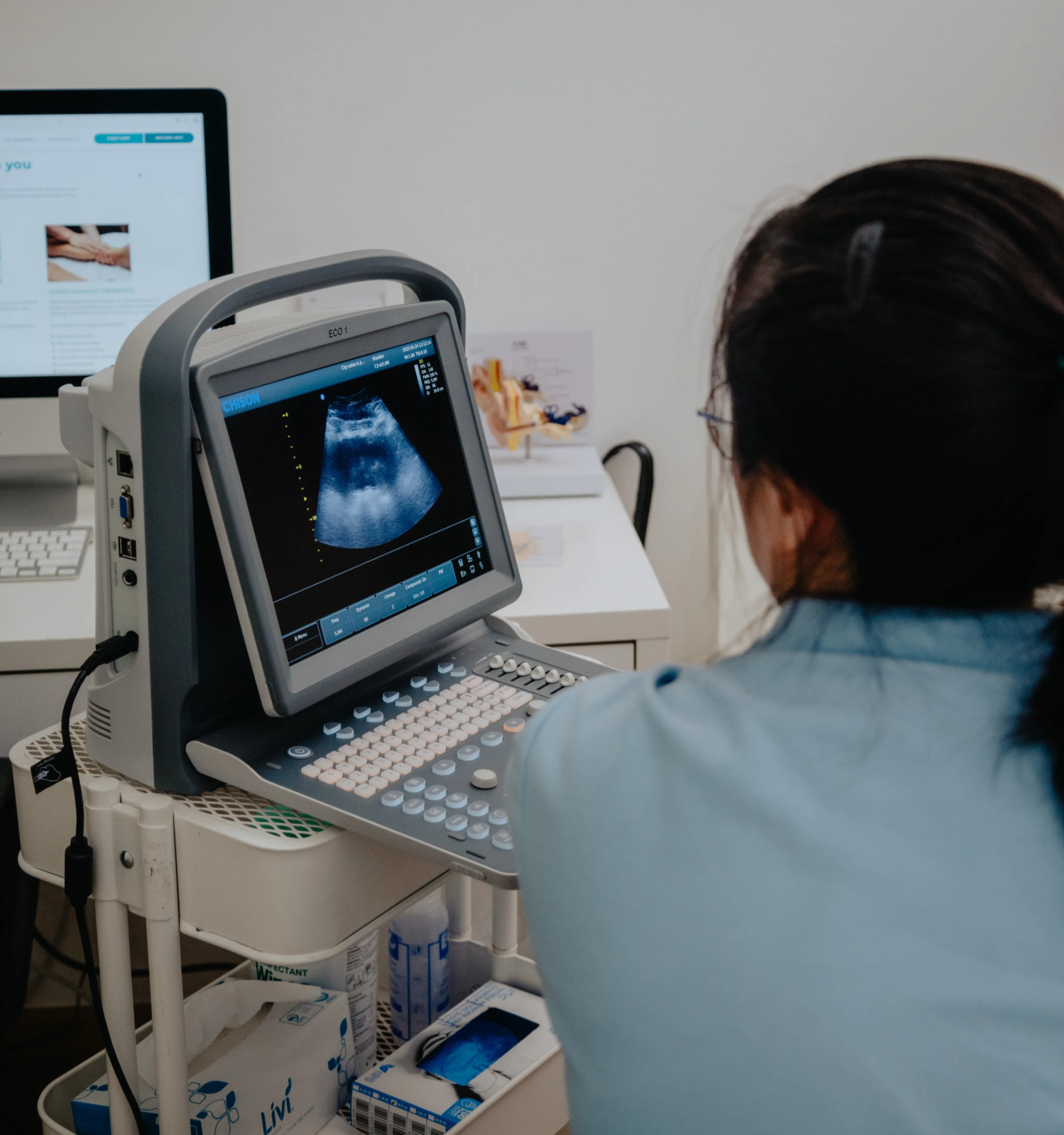 How do I know if I have PCOS