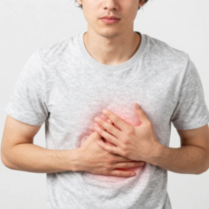 Acid reflux symptoms