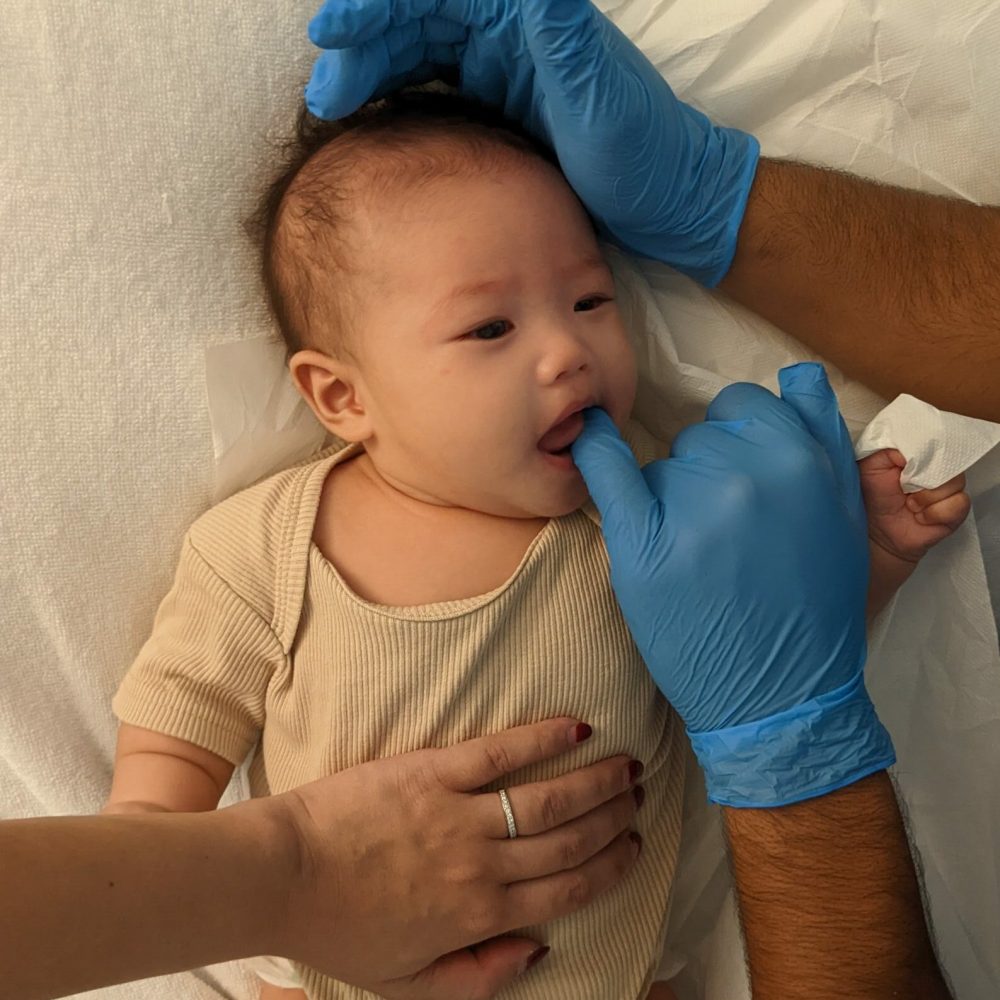 jaw tightness TMJ in babies